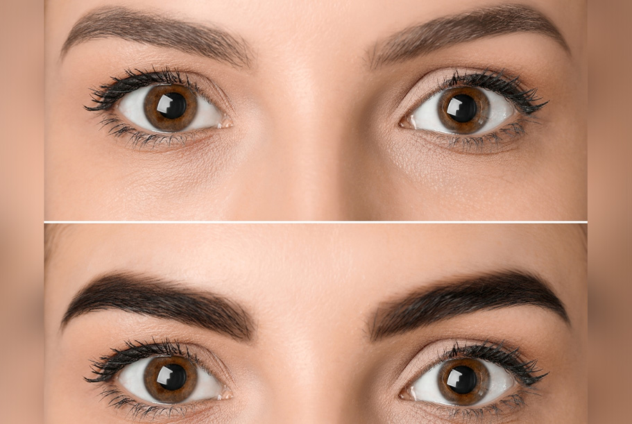 Eyebrow Micropigmentation Treatment
